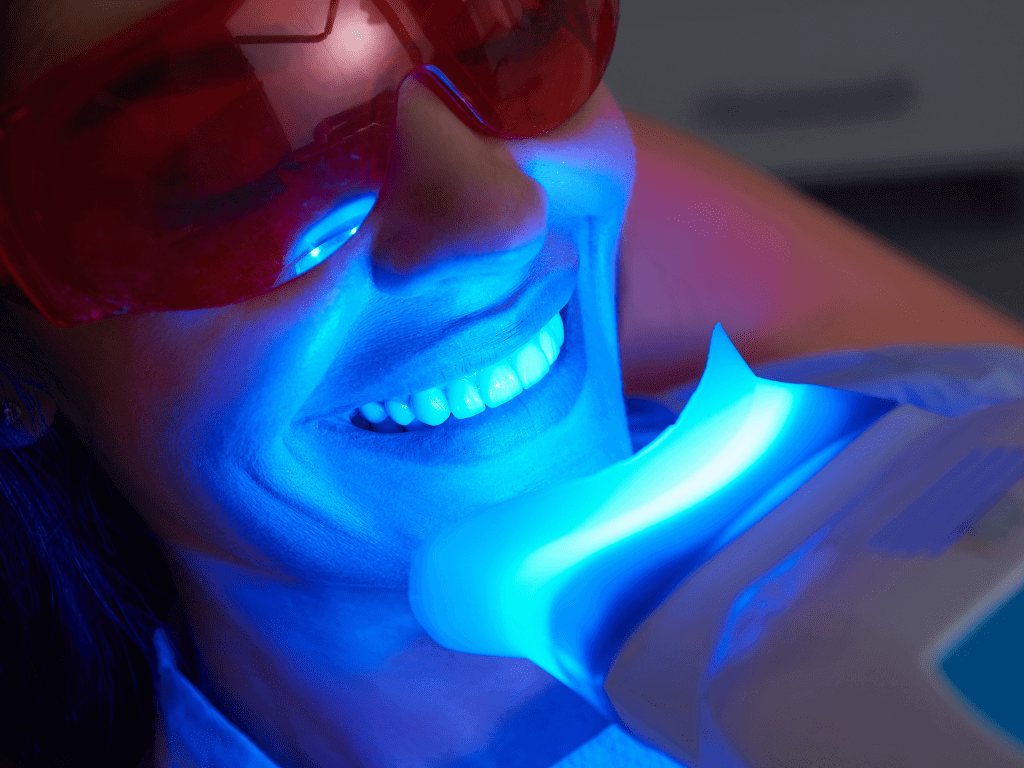 tratament albire dinti cu lampa UV