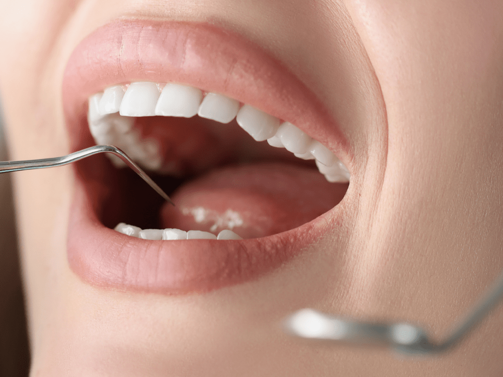 femeie la un control stomatologic inspectie dentara